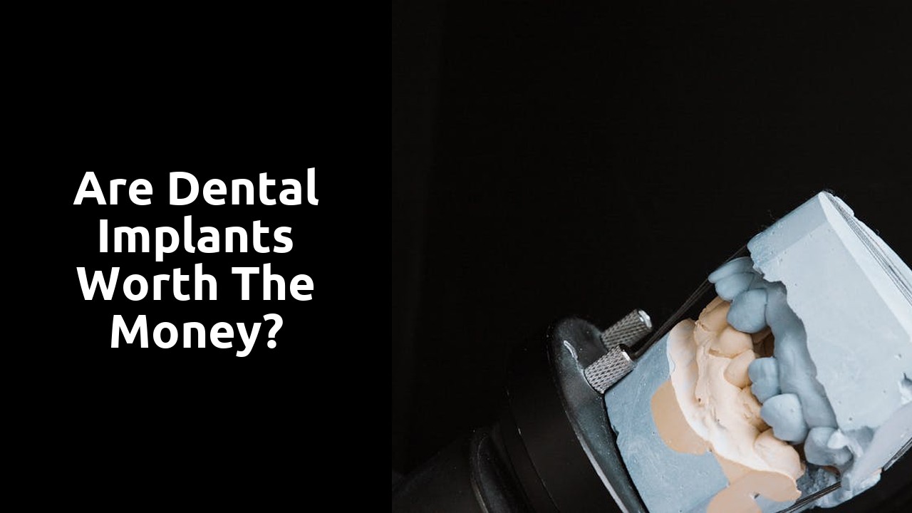 Are dental implants worth the money?