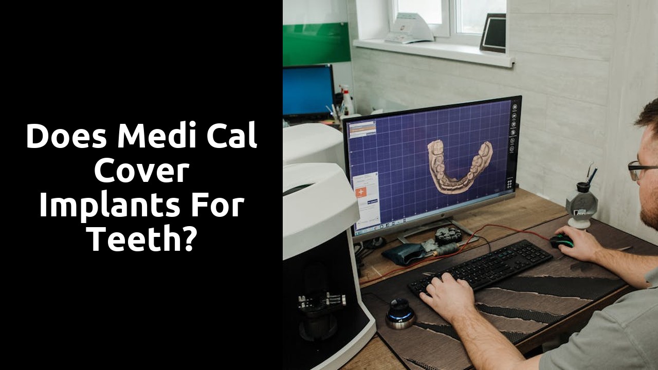 Does Medi Cal cover implants for teeth?