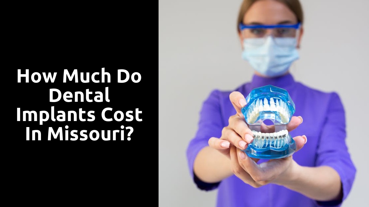 How much do dental implants cost in Missouri?