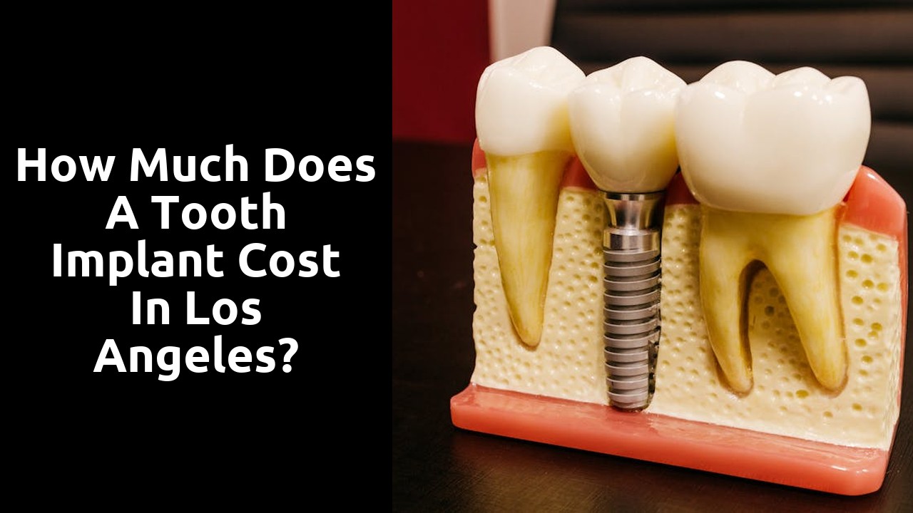 How much does a tooth implant cost in Los Angeles?