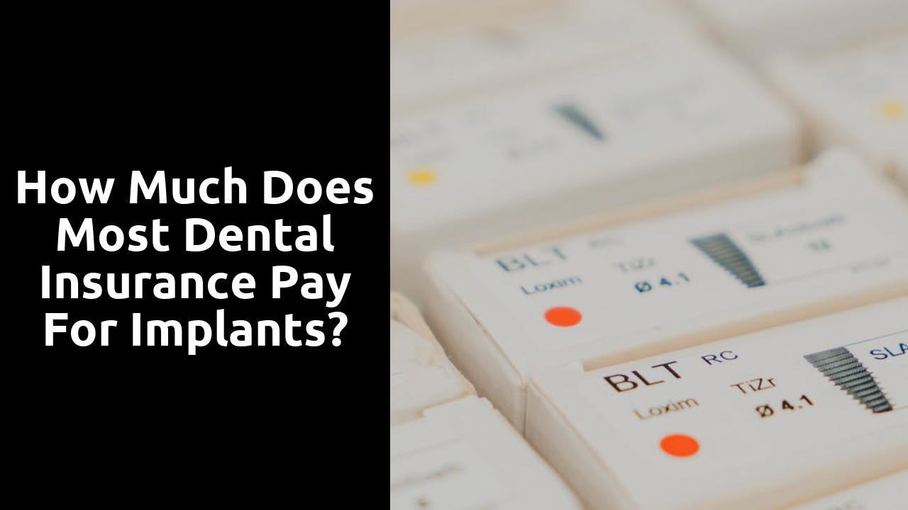 How much does most dental insurance pay for implants?