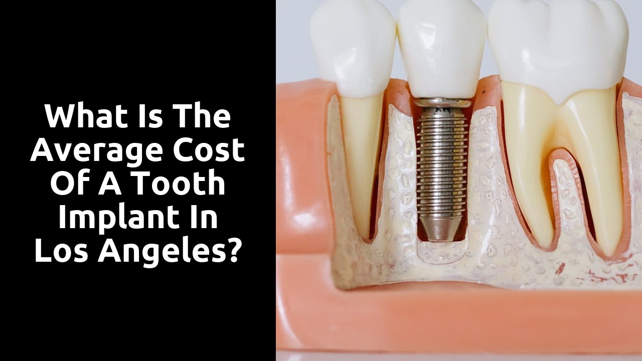 What is the average cost of a tooth implant in Los Angeles?