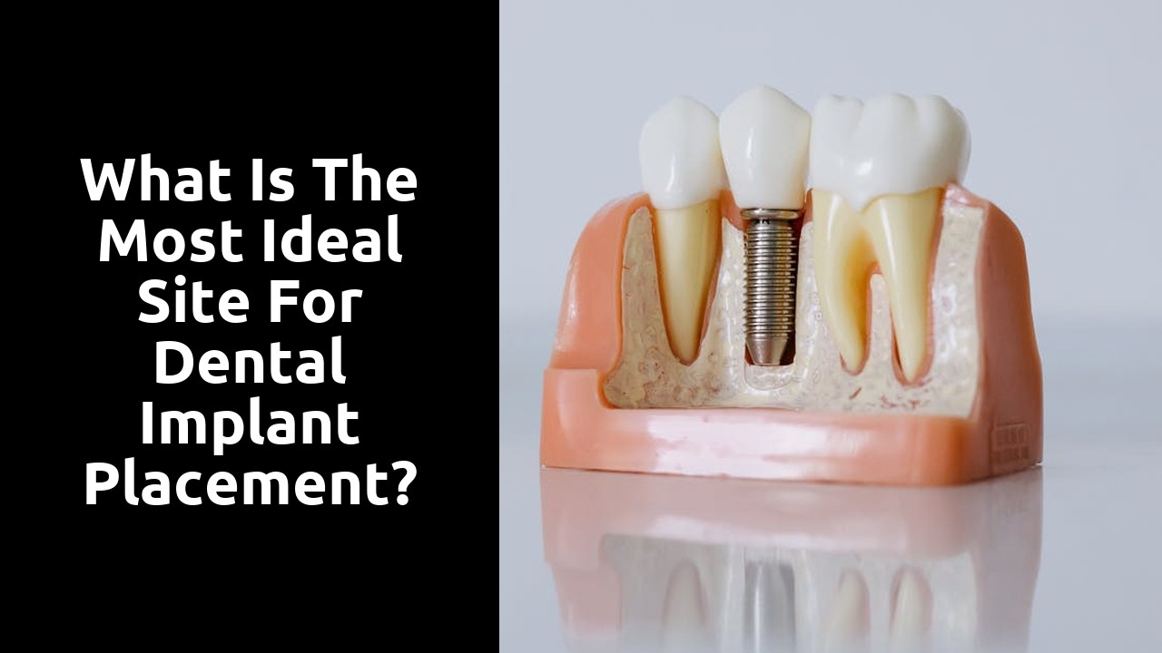 What is the most ideal site for dental implant placement?